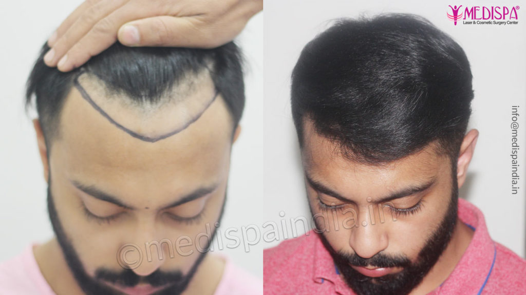 Hair Salon Chains in India % Studio99 Unisex Salon & Spa